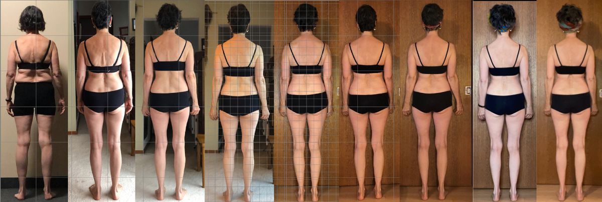 Heidi Back Before and After Fascia Release