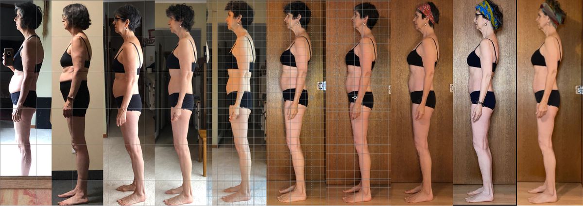 Heidi Profile Before and After Fascia Release